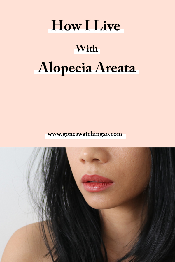 How I live with Hair Loss from Alopecia Areata. Green Beauty Blogger Gone Swatching xo