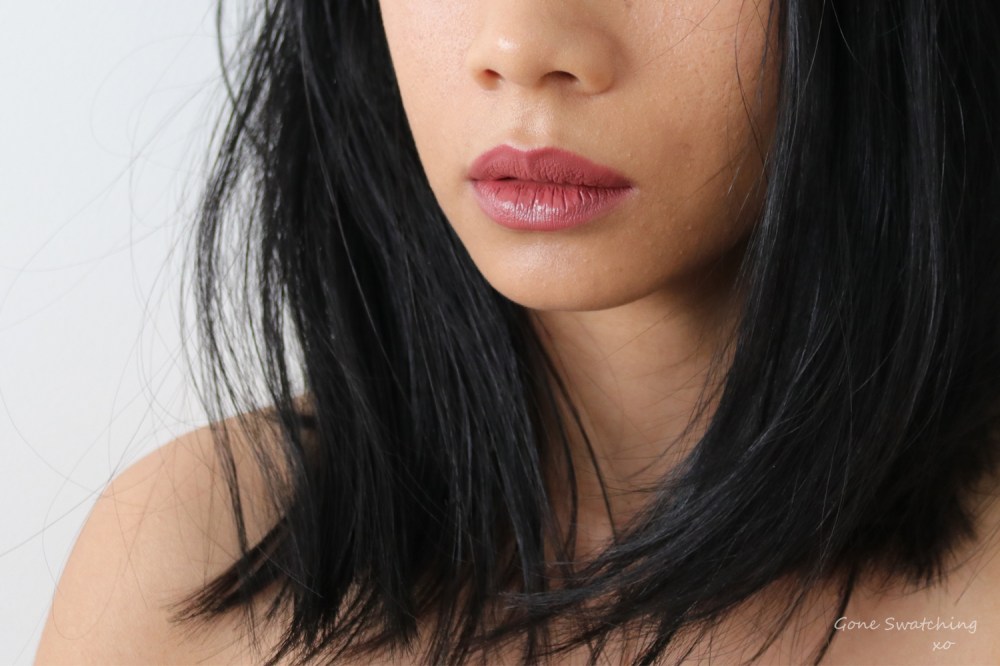 Living with Alopecia Areata - The Changes I Made to Stop Losing Hair